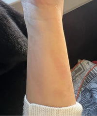 Problematic Skin Concerns Before After
