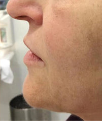 Problematic Skin Concerns Before After