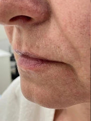 Problematic Skin Concerns Before After
