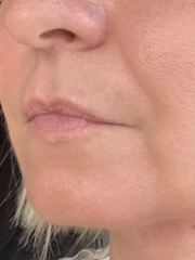 Problematic Skin Concerns Before After