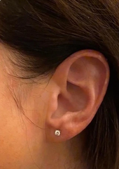 Problematic Skin Concerns Before After