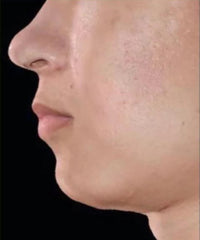 Problematic Skin Concerns Before After